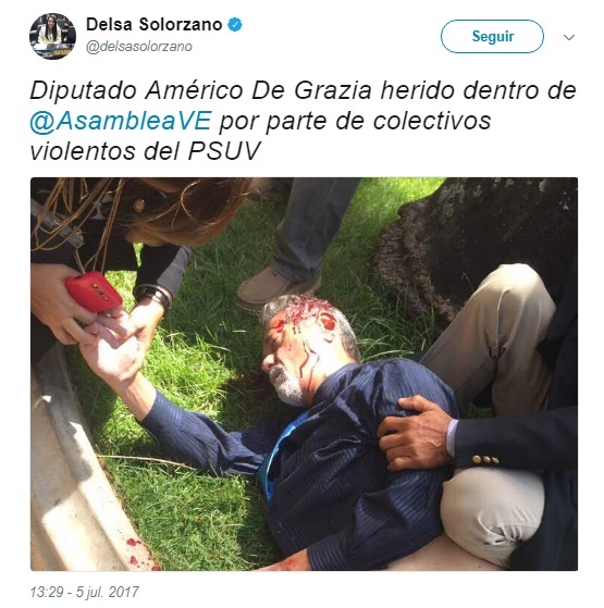 diptado herido venezuela1