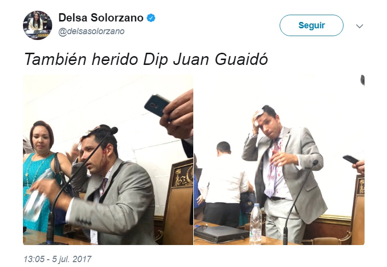 diputado herido venezuela