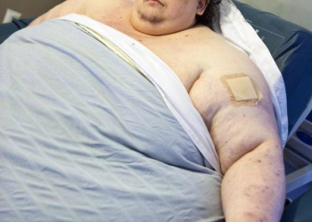 Muere el hombre más gordo del mundo