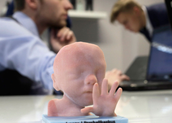 Imprimen en 3D a un bebe que aun no nació