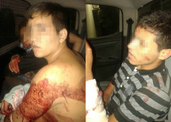 Insólito: Se defendió de ladrones con espada samurai, mira como quedaron