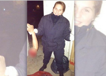 Insolito: Policía se sacó una foto con el brazo amputado de un accidentado