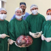 Una mujer tenia un tumor de 15 kilos en abdomen y pelvis