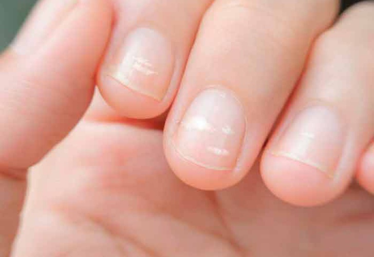 ¿Tienes uñas amarillas o débiles? Esto dicen sobre tu salud