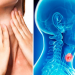 Todo lo que debes saber del silencioso cáncer de garganta