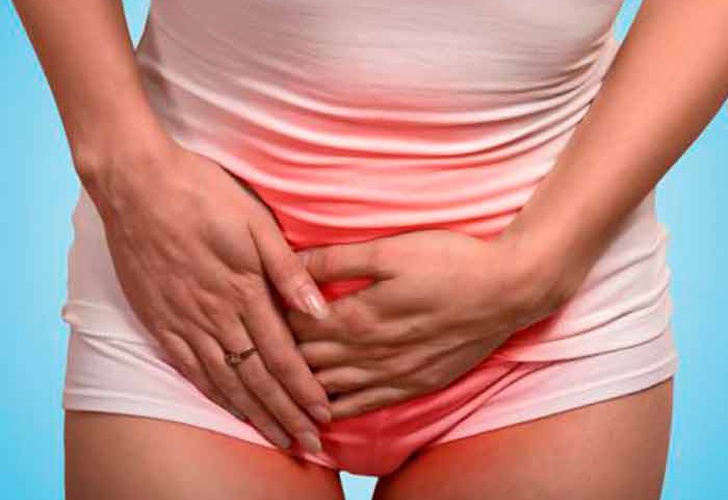 Alerta: Estos son síntomas de cáncer de ovario que algunas ignoran