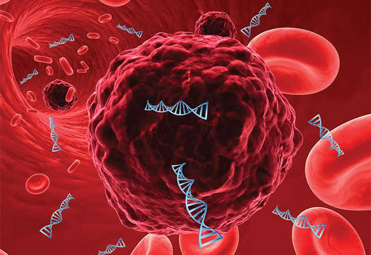 Conocé la nueva técnica que da esperanzas de controlar el cáncer