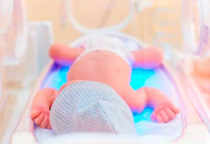 30 millones de bebés necesitan cuidado especial para sobrevivir