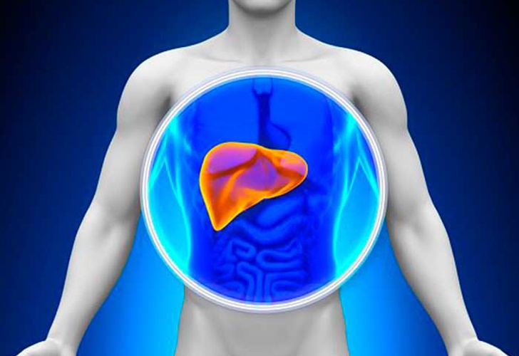 El 20 % de casos de hígado graso no alcohólico pueden derivar en cirrosis
