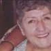 Murió la mujer a la que le amputaron la pierna equivocada