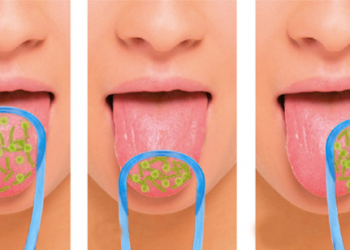 ¿Es importante cepillarse la lengua?
