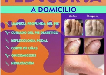 PODOLOGIA A DOMICILIO
