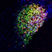 Descubren el interruptor cerebral del dolor