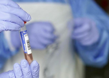 Coronavirus: confirman otro caso en Caimancito y ya son 76 contagios en Jujuy