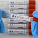 Se encuentran en vigilancia epidemiológica 1871 personas asintomáticas