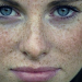 Pecas y lunares, ¿conoces la diferencia?