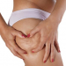 Celulitis, qué es y cómo eliminarla