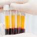 Coronavirus: ¿el plasma es la única esperanza para detenerlo?