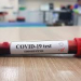 Dieron positivo para COVID-19 siete contactos estrechos del jujeño contagiado