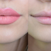 ¿Cómo prevenir el envejecimiento de los labios?