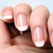 Duras y de acero: Mira cómo hacer crecer tus uñas con ajo en ¡3 días!