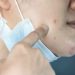 Descubre cómo tratar el acné producido por el uso de mascarillas contra el contagio del Covid-19