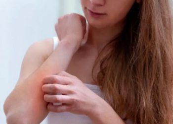 Cuestión de piel... ¿Qué es la dermatitis atópica?