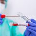 Este martes reportan 3 casos de coronavirus y no se lamentó ninguna víctima fatal en Jujuy