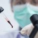 Alarma en Brasil por el hallazgo de una nueva variante de coronavirus