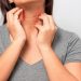 ¿Qué es el lupus, la enfermedad que afecta más a las mujeres, y cómo se lo trata?