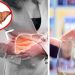 Revelan qué ejercicio físico ayuda a prevenir el hígado graso