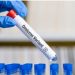 Las variantes de coronavirus que impulsan la nueva ola en Argentina: ¿cuáles son los síntomas para detectarlas?
