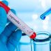 Brote de Legionella en Tucumán: ya son 22 los afectados, de los cuales 6 murieron