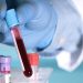 Un análisis de sangre podría detectar el cáncer antes de que aparezcan los síntomas