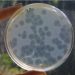 Las infecciones bacterianas son la segunda causa de muerte en el mundo