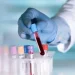 Desarrollan análisis de sangre que detecta 18 tipos de cáncer