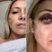 Se conocieron las fotos de Fabiola Yañez con golpes en la cara y el cuerpo