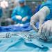 Por primera vez, cirujanos argentinos extrajeron un tumor cardíaco a través de la axila