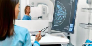 Cáncer de mama: el 90% de los casos pueden curarse si se detectan a tiempo