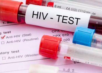 Día mundial del VIH: por qué los contagios no bajan a pesar de los nuevos métodos de prevención