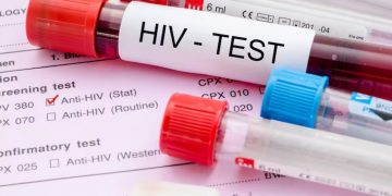 Día mundial del VIH: por qué los contagios no bajan a pesar de los nuevos métodos de prevención